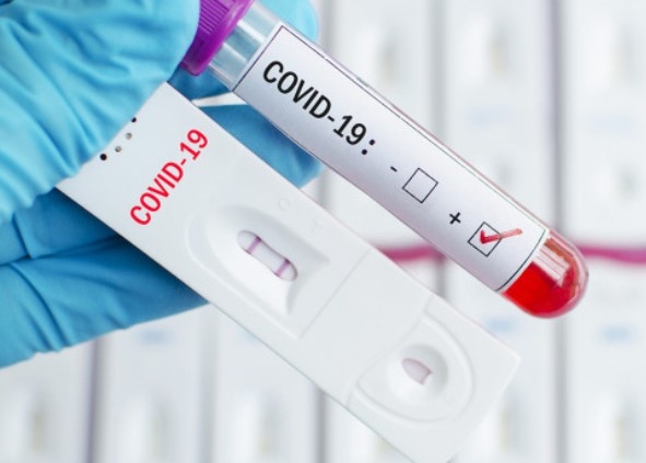 2181 нови случаи с коронавирус са отчетени за последното денонощие Направени